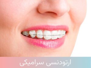 ارتودنسی سرامیکی